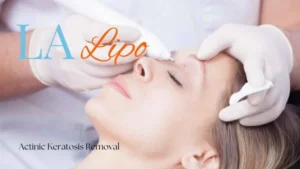 Woman receiving Actinic Keratosis Removal Treatment Hampstead Heath