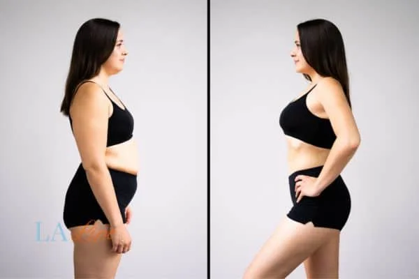 link between body image and mental health Hampstead Heath