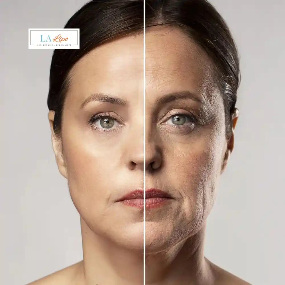 How Can You Tell If Non-Surgical Skin Tightening Is Right for You Hampstead Heath?